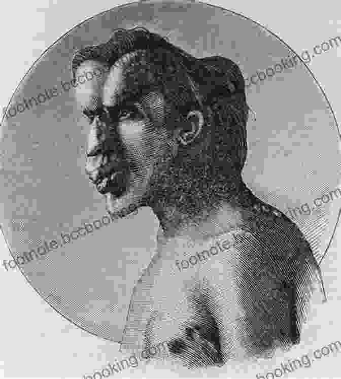 Black And White Portrait Of Joseph Merrick, The Elephant Man, Showing His Deformed Head And Facial Features. The True History Of The Elephant Man